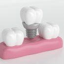 더라은치과의원 이미지