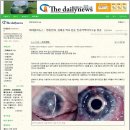 광명김안과의원 이미지