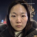 메이크영 에스테틱 | 노량진 상도 대방 경락 전문점 - 메이크영 에스테틱 : 윤곽관리 2단계 솔직 후기 (내돈내산)