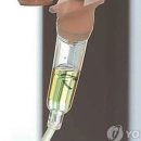 링거