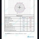 드림헬스 | 천안 단두증 하니헬멧 한헬스케어 교정6달째 막달후기, 추천인(기프티콘드림)지역상관없어요