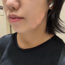 유라인 - 강릉시 사임당로 129 | 유라인클리닉 윤곽주사 후기 브이컷주사 찐 후기