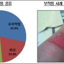 파스 부작용 주의보…"약국 복약지도 잘해주세요" 이미지