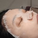 청량리 | 청량리피부과 티타늄리프팅 후기