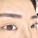 눈, 여기다 이미지