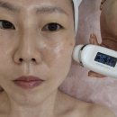 대구 피부관리, 한번의 관리로도 확실한 효과 플라미뷰티에서 리프팅받은 후기