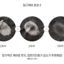 더스트제로 이미지