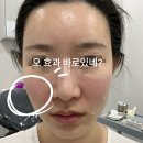 진주복음병원 | 내돈내산 진주 미미썸의원 스컬트라 볼패임 솔직후기