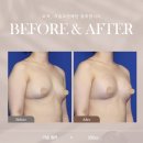 케빈비어 이미지