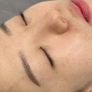 닥터큐피부체험