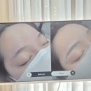 ♨️등이 이렇게 가벼울 수 있다고? 동탄 피부샵 핫스톤 테라피 솔직후기✨