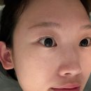 민힐링케어몰 | 대구남구에스테틱 추천! 민레스트 면역업케어와 데콜데 관리 후기