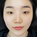 채우림광명 | [광명피부관리추천] 미백관리 기미잡티제거 채우림 광명 방문후기