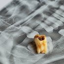 섬세한사랑니치과의원 이미지