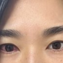 서울리더스안과의원 이미지