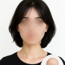 비이케이더블유좋은강안병원지점 | [부산항암가발] 머리카락보다 더 소중한 용기를 응원합니다.