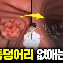 이런 증상 있으면 장 독소가 심각한 상태입니다. 장 독소 제거 5단계 방법(모든 질병은 장에서 시작된다) 이미지