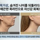 설내과의원 Daum카페