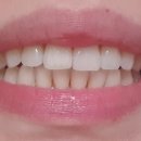 투스노스 이미지