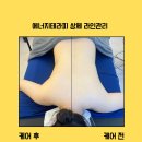 금손테라피 - 수원시 권선구 세권로 186 | 인천 서구 바디케어 금손테라피 붓기관리 프리미엄 에너지테라피 후기