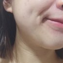 연세마이뷰의원 이미지