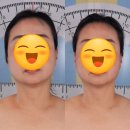 김해관동우체국 | 장유 에스테틱 추천/즉각적인 턱선 정리 윤곽효과/미선에스테틱 윤곽리프팅 후기