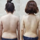 미소라인 피부관리
