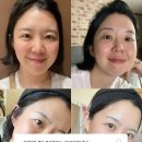 리셋의원 | 바디프로필 전문 분당피부과 리셋의원에서 트리플바디부터 이브타이탄까지