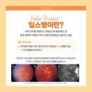 젊은눈안과의원 이미지