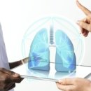 기침과 호흡곤란을 유발하는 폐렴 증상과 원인 예방법 이미지