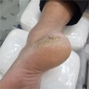안산발각질 원인을 알려준 곳 포쉬네일 오벨리네일푸스 족보있는그녀들 안산점