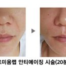 황실피부 이미지