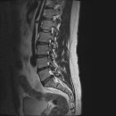 엠알아이 이미지