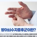 방아쇠수지증후군 완치 및 증상 해결 방법 이미지