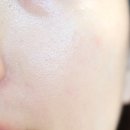 아이비에스테틱 이미지