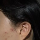 향염채단 | [안산 고잔동 에스테틱] 드위에스테틱; 트러블 관리, 진정관리, 수분관리