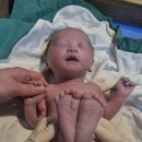 제일산부인과의원 | 아이제일산부인과 제왕절개 후기 (특실,1인실) 및 준비물