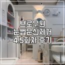 후후브로 | 동안되는 비결,, 브로우원 눈썹문신제거 내돈내산 후기(4,5회차)(전체회차 비교)
