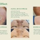 플라리온