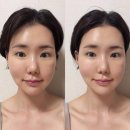 (주)아이존 | 셀비전 쎄라쥬 후기｜HIFU EMS 올인원 홈케어 디바이스 추천