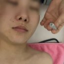 세븐일레븐 의정부센트럴타워점 | 의정부역 에스테틱 파워트리 V라인관리 잘 하는 강에스테틱 후기