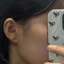 밀크피부과의원 | 서울 신사역피부과 세레아의원 티타늄리프팅 30kj 탄력 변화 솔직 리뷰