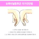엠케이한방병원 | 손목터널 증후군으로 고생한 후기