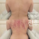마산댓거리 피부관리 상체관리 끝판왕 씨앤씨에스테틱 추천후기