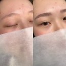 신대성광고 | 순천여자 눈썹문신 이건 알고 받으세요!