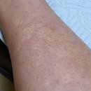 아띠의원 이미지