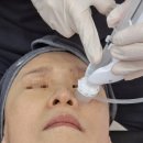 성전하나의원 | 순천 에르제의원 쥬베룩스킨 보톡스 내돈내산 솔직후기