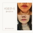 (주)미희 | 홍대 피부과 팔자 주름 쫙쫙 펴진 후기 미희 주사 (AKA. 콜라겐 주사)