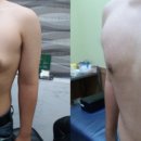 서울수비뇨의학과의원 네이버블로그