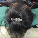김호증모가발·소호헤어